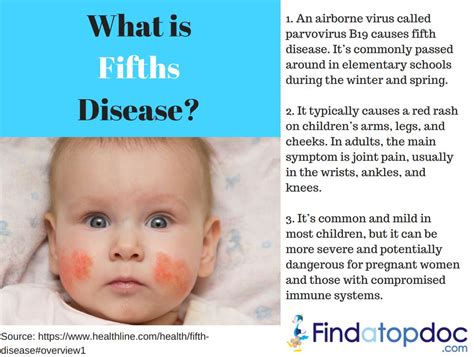 FindaTopDoc Blog: What is Fifths Disease: Causes and Symptoms