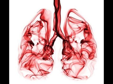 An Approach to Hemoptysis - 5 - YouTube