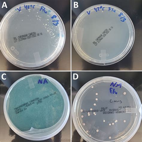 Figure 1 - Candida auris Discovery through Community Wastewater Surveillance during Healthcare ...