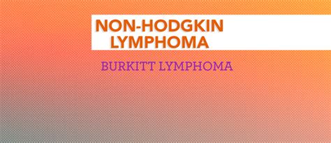 Treatment of Burkitt Lymphoma - CancerConnect