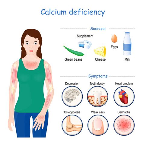 The Benefits of Using Calcium Supplements – IronMag Bodybuilding & Fitness Blog