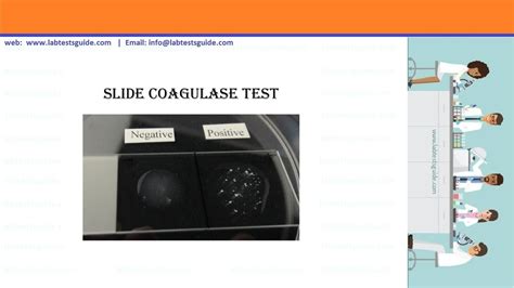 Coagulase Test : Principle, procedure and interpretation | Lab Tests Guide