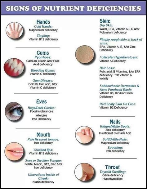 Micronutrient Deficiency Diseases In Humans | nutrienkarbo