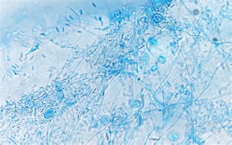 Light microscope image of mycelial aggregates, spores and chlamydospores (large round to egg ...