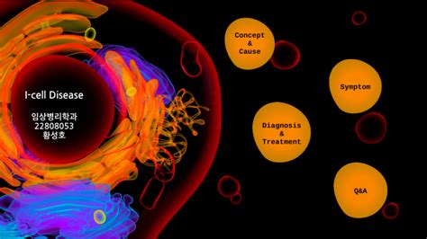 I-cell disease by 성호 황