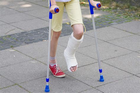 When Your Child Breaks a Bone: Everything You Need to Know About Wearing a Cast | Parents