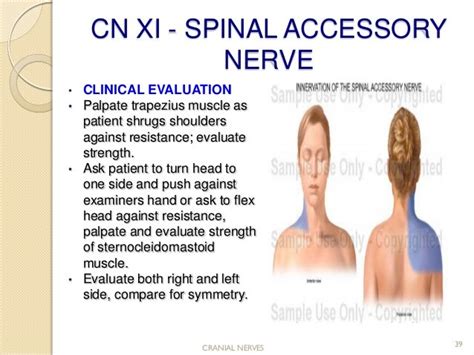 Cranial nerve assessment..Simple and Easy to perform for medics and P…