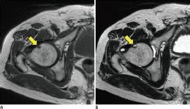 :: KJR :: Korean Journal of Radiology