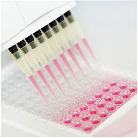 Human TGF-β1 ELISA Kit