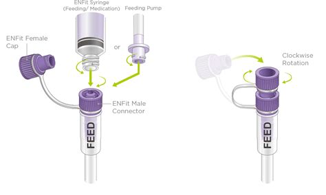 A Brief Introduction of 2023 New Product with ENFit Connector - Fortune Medical Instrument Corp.