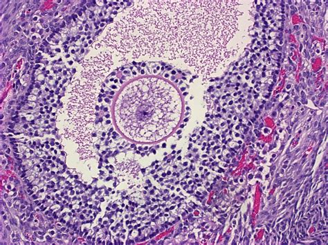 Ovary Histology Drawings