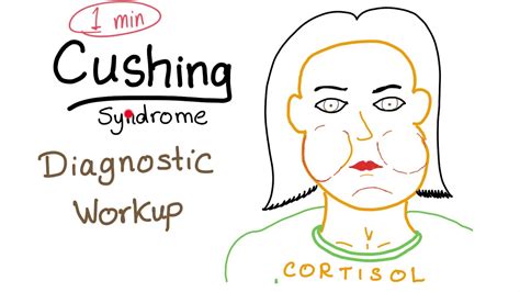 Cushing Syndrome Workup in 1 minute (USMLE) - YouTube