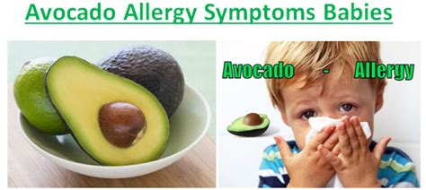 Avocado Allergy Symptoms Treatment - Fruits Facts