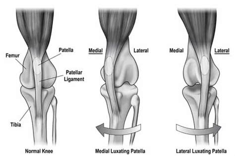 Condition Breakdown: Luxating Patella