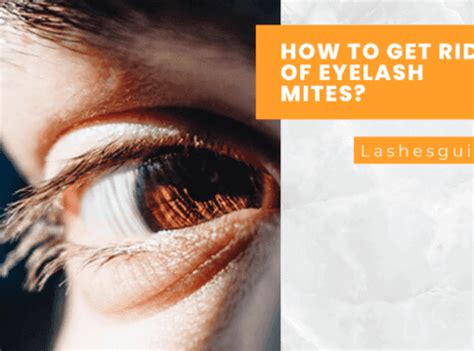 How to Get Rid of Eyelash Mites? - Lashes Guide