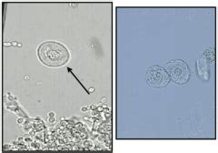 Microscopic Elements of Urine flashcards | Quizlet