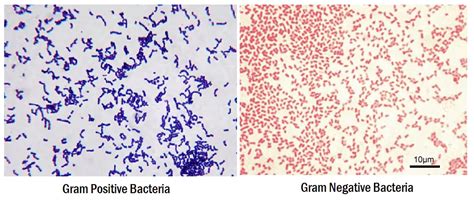 Gram Staining : Principle, Procedure, Interpretation and Animation | LaboratoryInfo.com