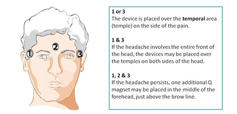 Headaches and Migraine Treatment with Magnetic Therapy using Q Magnets