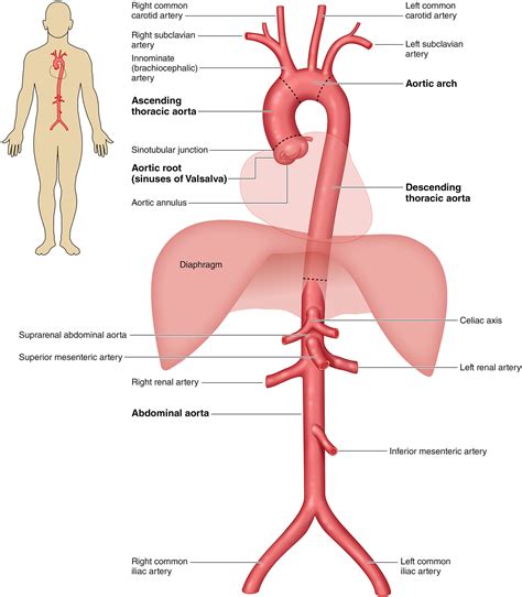 2022 ACC/AHA Guideline for the Diagnosis and Management of Aortic Disease: A Report of the ...