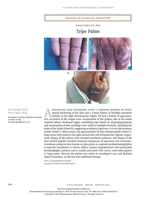 (PDF) Images in clinical medicine. Tripe palms