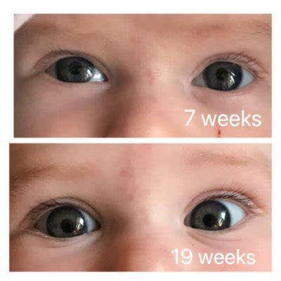 Eyes still grey at 5 months? | BabyCenter