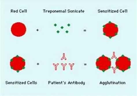 TPHA: Principle, Procedure, Results, Interpretations • Microbe Online