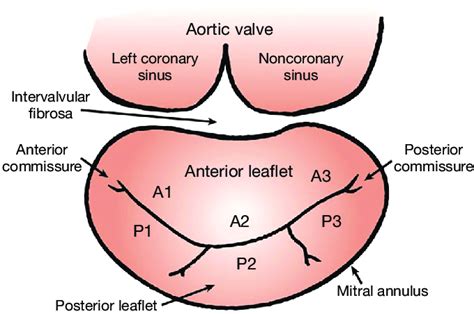 Mitral Valve Diagram