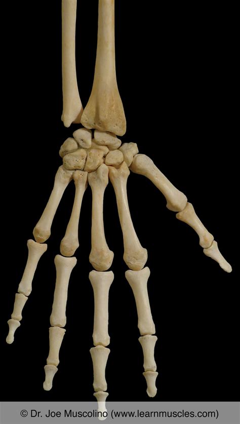 Metacarpophalangeal Joints - Learn Muscles