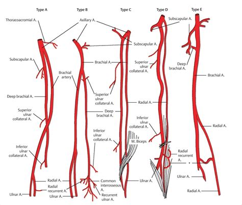 11 Vascular Anatomy of the Upper Extremity | Musculoskeletal Key