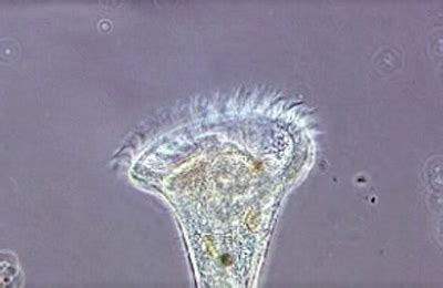 Stentor (Protozoan) Videos | MicroscopyU