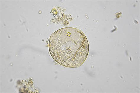 Arcella | The Microscopic Life of Shetland Lochs