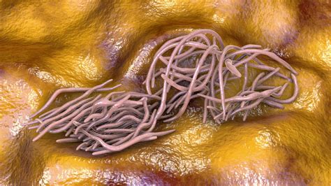 What are pinworms? Symptoms and treatment | The US Sun