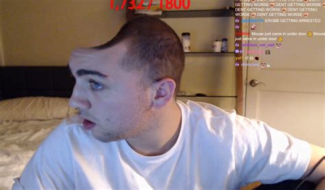 Fundraiser thread for mizkif's dent transplant (unedited image ...