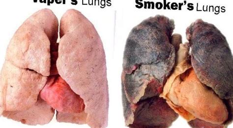 Can Smoking Marijuana Cause Lung Cancer - NCSM