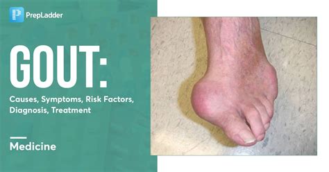 Gout: Causes, Symptoms, Risk Factors, Diagnosis, Treatment