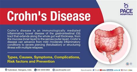 Crohn's Disease - Symptoms, Causes, Complications & Prevention