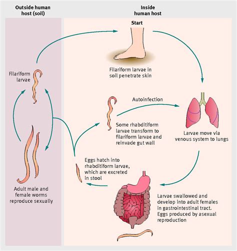 Strongyloides stercoralis infection | The BMJ