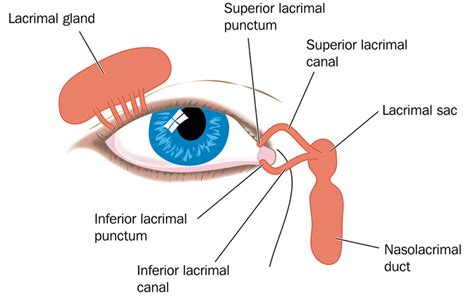 Treatment for blocked tear duct. – The Eye Center- Dr. Mahnaz Naveed Shah & Associates, Karachi