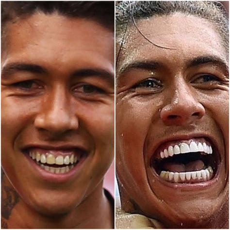 Roberto Firmino Wife, Girlfriend, What Happened to His Teeth? » Celebtap