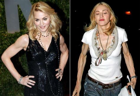 madonna plastic surgery pictures | This Blog Rules | Why go elsewhere?