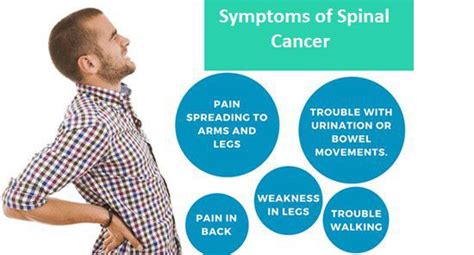 Symptoms of spinal cancer - MEDizzy