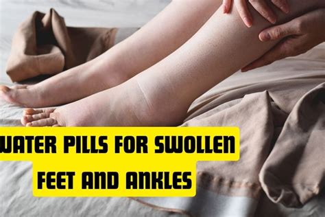 Water Pills for Swollen feet and Ankles - Healthpluscity