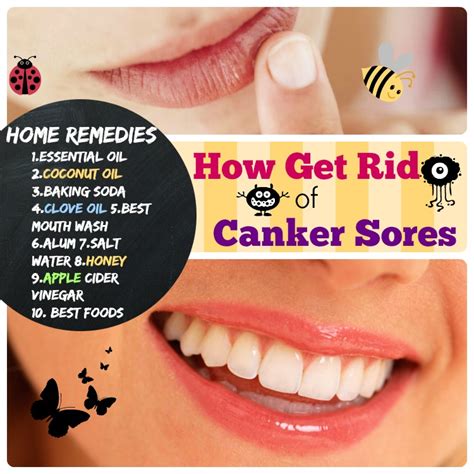 #10 Home Remedies for Canker Sores: Happy Lips