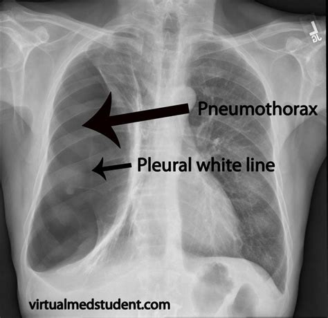 110 best images about Radiographic Pathology on Pinterest | Yellow ...