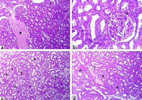 Photomicrographs of kidney sections stained with HE from: a and b) Rats ...