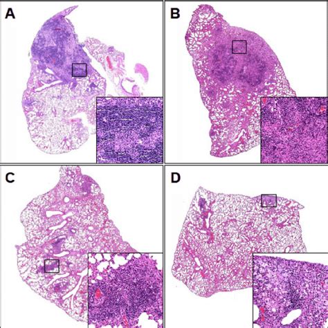 Histological appearance of pulmonary granulomas. Lesions represented by... | Download Scientific ...