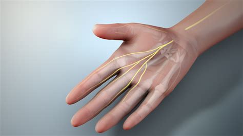 Carpal Tunnel Syndrome Symptoms vs. Impinged Neck Nerve » Scary Symptoms