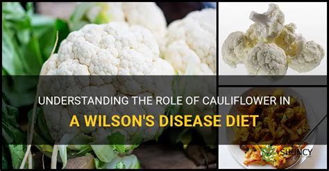 Understanding The Role Of Cauliflower In A Wilson's Disease Diet | ShunCy