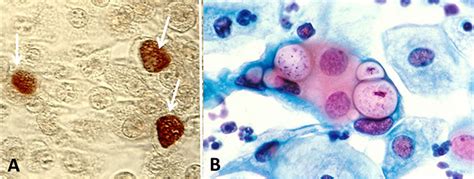 Chlamydia and Infections - Encyclopedia of Arkansas