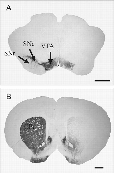 Substantia Nigra Mouse